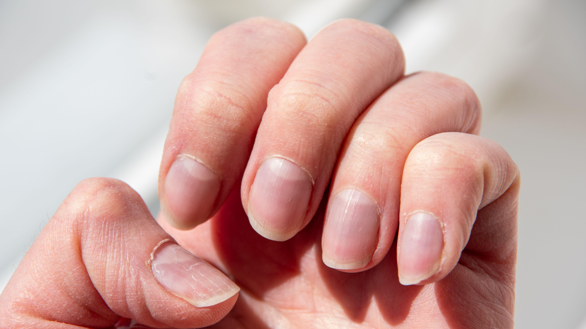運動すると爪が伸びるスピードが変わる、という話 Jun .26