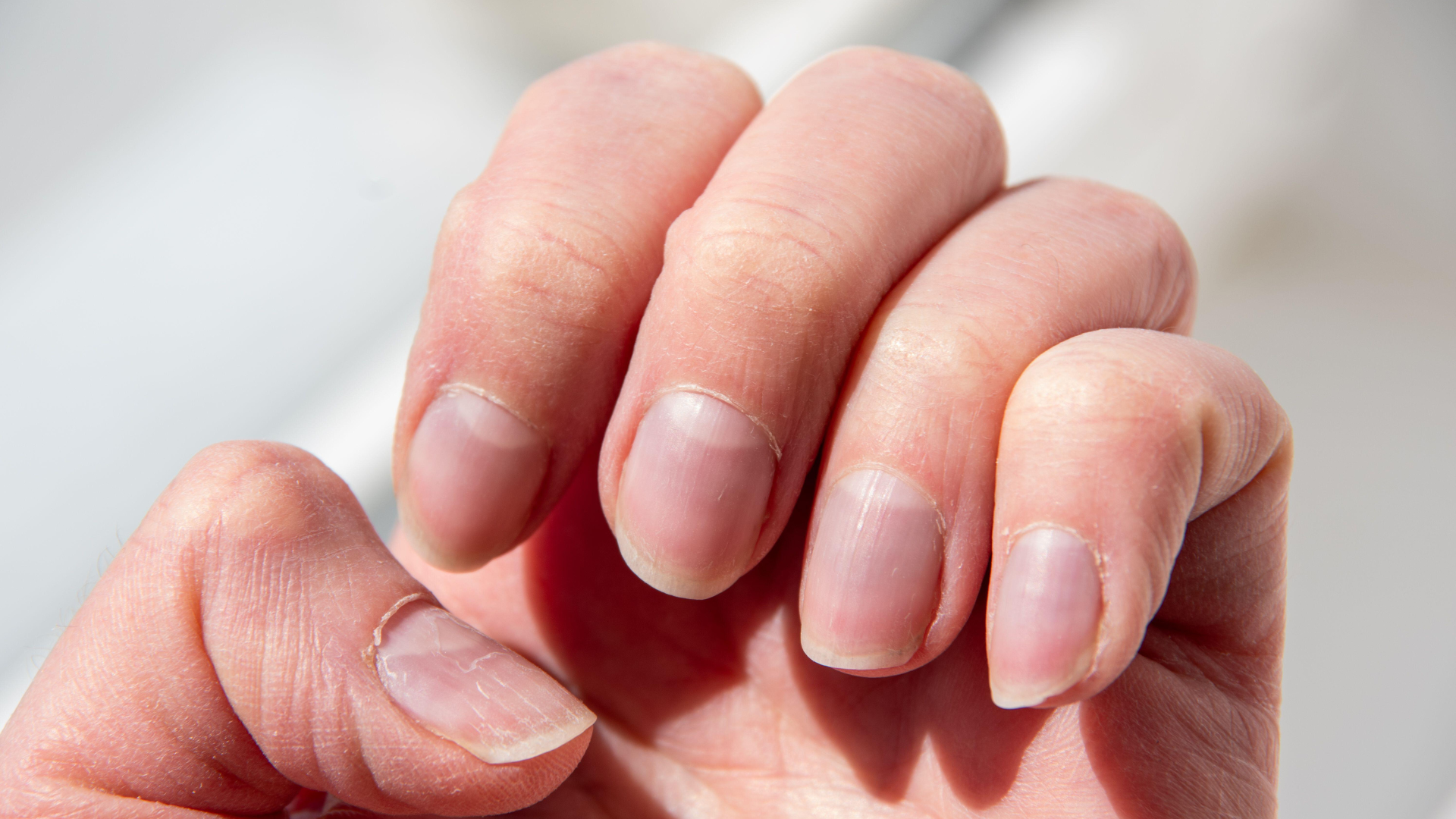 運動すると爪が伸びるスピードが変わる、という話　Jun .26